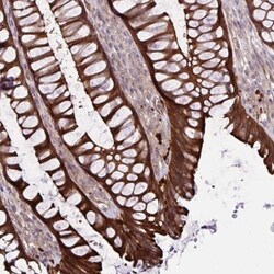GLTP Antibody, Novus Biologicals 0.1mL; Unlabeled:Antibodies, Polyclonal