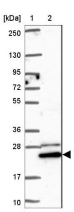 GLTP Antibody, Novus Biologicals 0.1mL; Unlabeled:Antibodies, Polyclonal