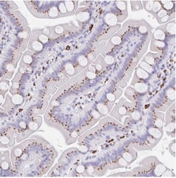 GLTPD1 Antibody, Novus Biologicals 0.1mL; Unlabeled:Antibodies, Polyclonal