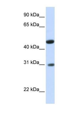 GLTPD2 Antibody, Novus Biologicals:Antibodies:Primary Antibodies