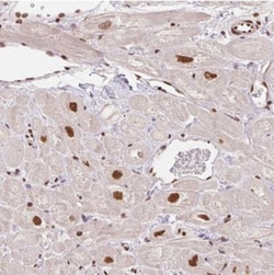 GLTSCR1 Antibody, Novus Biologicals 0.1mL; Unlabeled:Antibodies, Polyclonal