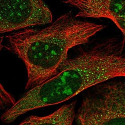 GLTSCR2 Antibody, Novus Biologicals 25 &mu;L; Unlabeled:Antibodies, Polyclonal