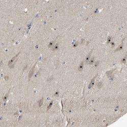 GLTSCR2 Antibody, Novus Biologicals 25 &mu;L; Unlabeled:Antibodies, Polyclonal