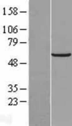 Novus Biologicals&trade;&nbsp;GLTSCR2 Overexpression Lysate