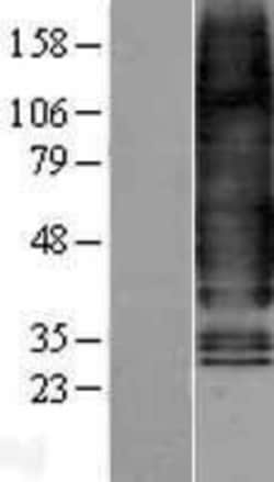 Novus Biologicals&trade;&nbsp;Glucagon R/GCGR Overexpression Lysate
