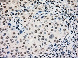 Glucokinase/GCK Antibody (OTI3E3), Novus Biologicals 0.1mL; Unlabeled:Antibodies,