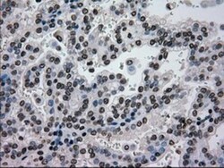 Glucokinase/GCK Antibody (OTI3E3), Novus Biologicals 0.1mL; Unlabeled:Antibodies,