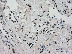 Glucokinase/GCK Antibody (OTI3E3), Novus Biologicals 0.1mL; Unlabeled:Antibodies,