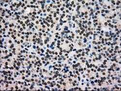 Glucokinase/GCK Antibody (OTI3E3), Novus Biologicals 0.1mL; Unlabeled:Antibodies,