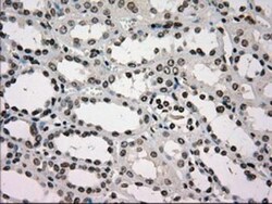 Glucokinase/GCK Antibody (OTI3E3), Novus Biologicals 0.1mL; Unlabeled:Antibodies,