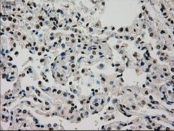 Glucokinase/GCK Antibody (OTI3E3), Novus Biologicals 0.1mL; Unlabeled:Antibodies,