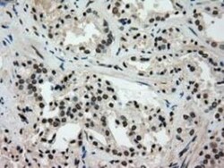Glucokinase/GCK Antibody (OTI3E3), Novus Biologicals 0.1mL; Unlabeled:Antibodies,