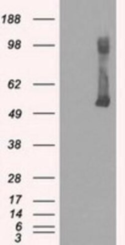 Glucokinase/GCK Antibody (OTI3E3), Novus Biologicals 0.1mL; Unlabeled:Antibodies,