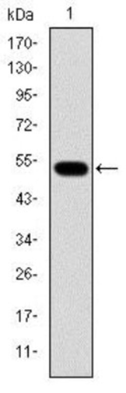 Glucokinase/GCK Antibody (4G6), Novus Biologicals 0.1mL; Unlabeled:Antibodies,