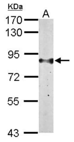 Glucose 1-dehydrogenase Antibody, Novus Biologicals 0.1mL; Unlabeled:Antibodies,