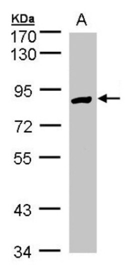 Glucose 1-dehydrogenase Antibody, Novus Biologicals 0.1mL; Unlabeled:Antibodies,