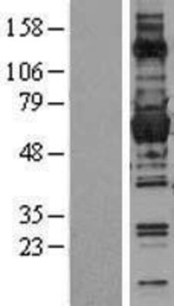 Novus Biologicals&trade;&nbsp;Glucose 6 Phosphate Dehydrogenase Overexpression Lysate