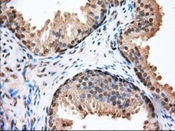 Glucose 6 phosphate isomerase Antibody (OTI2D2), Novus Biologicals 0.1mL;