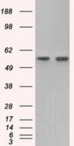 Glucose 6 phosphate isomerase Antibody (OTI2D2), Novus Biologicals 0.1mL;