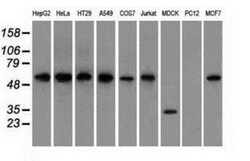 Glucose 6 phosphate isomerase Antibody (OTI2D2), Novus Biologicals 0.1mL;
