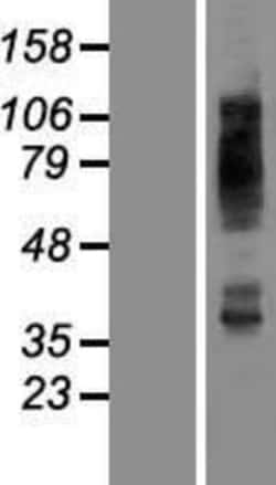 Novus Biologicals&trade;&nbsp;Glut4 Overexpression Lysate