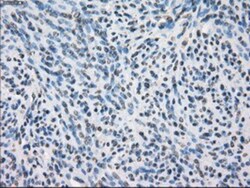 Glucose Transporter GLUT6 Antibody (OTI7E3), Novus Biologicals 0.1mL; Unlabeled:Antibodies,
