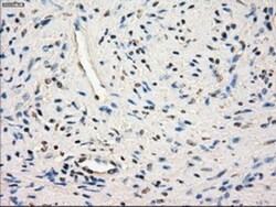 Glucose Transporter GLUT6 Antibody (OTI7E3), Novus Biologicals 0.1mL; Unlabeled:Antibodies,