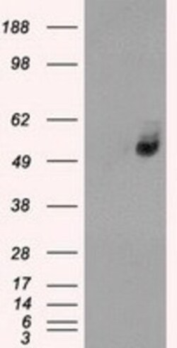 Glucose Transporter GLUT6 Antibody (OTI7E3), Novus Biologicals 0.1mL; Unlabeled:Antibodies,