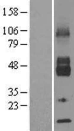 Novus Biologicals™ Glucose Transporter GLUT6 Overexpression Lysate