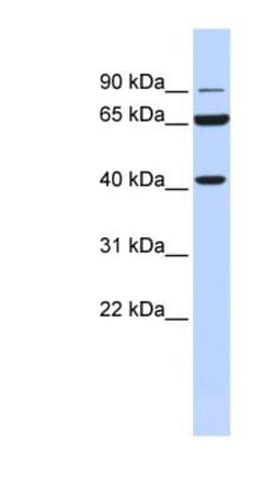 Glucose 1-dehydrogenase Antibody, Novus Biologicals:Antibodies:Primary