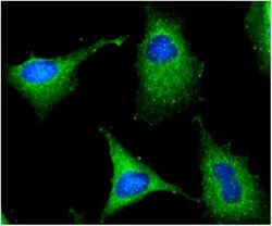 Glucose 6 Phosphate Dehydrogenase Antibody (2F6) - BSA Free, Novus Biologicals