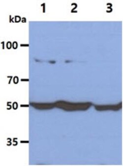Glucose 6 Phosphate Dehydrogenase Antibody (2F6) - BSA Free, Novus Biologicals
