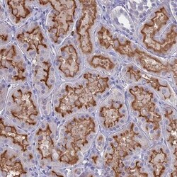 Glucose Transporter GLUT6 Antibody, Novus Biologicals 25 &mu;L, Unlabeled:Antibodies,