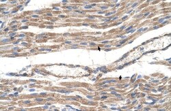 Glucose Transporter GLUT6 Antibody, Novus Biologicals 0.1mg; Unlabeled:Antibodies,