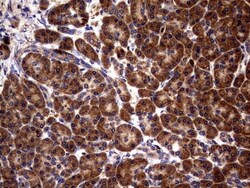 Glucosylceramidase/GBA Antibody (OTI4G4), Novus Biologicals 0.1mL; Unlabeled:Antibodies,