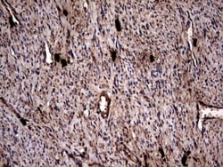 Glucosylceramidase/GBA Antibody (OTI4G4), Novus Biologicals 0.1mL; Unlabeled:Antibodies,