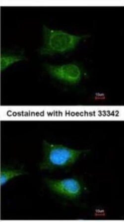 Glucosylceramidase/GBA Antibody, Novus Biologicals 0.1mL; Unlabeled:Antibodies,