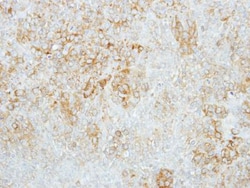 Glucosylceramidase/GBA Antibody, Novus Biologicals 0.1mL; Unlabeled:Antibodies,