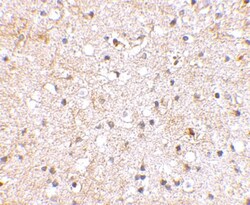 GluR5/GRIK1 Antibody - BSA Free, Novus Biologicals 0.1mg; Unlabeled:Antibodies,