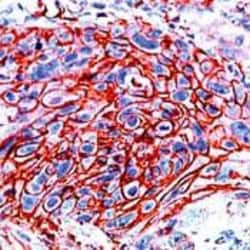 Glut1 Antibody, Novus Biologicals 0.5 mL; Unconjugated:Antibodies, Polyclonal