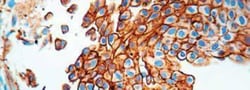 Glut1 Antibody, Novus Biologicals 0.5 mL; Unconjugated:Antibodies, Polyclonal
