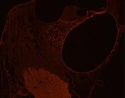 GLUT10 Antibody - BSA Free, Novus Biologicals 0.1mg; Unlabeled:Antibodies,
