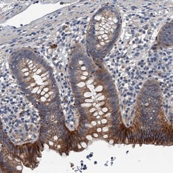 GLUT10 Antibody, Novus Biologicals 0.1mL; Unlabeled:Antibodies, Polyclonal