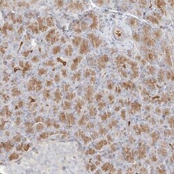 GLUT12 Antibody, Novus Biologicals 0.1mL; Unlabeled:Antibodies, Polyclonal