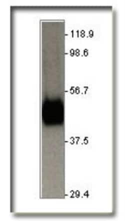 Glut1 Antibody, Novus Biologicals 0.025mg; Unlabeled:Antibodies, Polyclonal