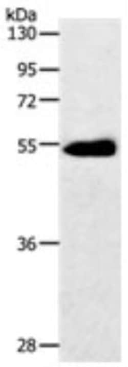Glut3 Antibody, Novus Biologicals 100 &mu;L, Unconjugated:Antibodies, Polyclonal