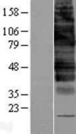 Novus Biologicals™ GLUT9 Overexpression Lysate