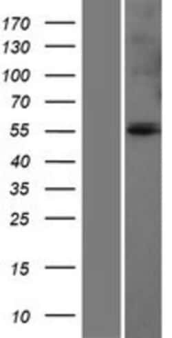 Novus Biologicals&trade;&nbsp;Glutamate Dehydrogenase Overexpression Lysate