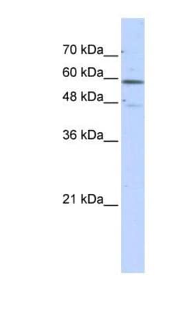 Glutamate Dehydrogenase 2/GLUD2 Antibody, Novus Biologicals 0.05mg; Unlabeled:Antikörper