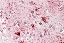 Glutamate Dehydrogenase Antibody, Novus Biologicals 0.1mg; Unlabeled:Antibodies,